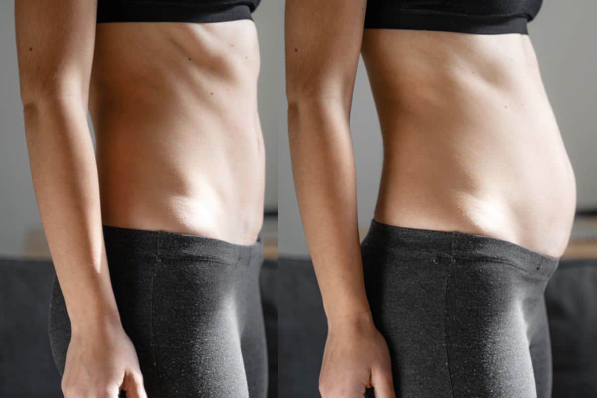 How long does diastasis recti take to improve Waltham's Cross?