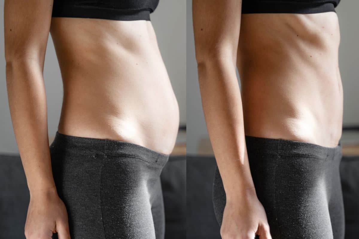 Post-Pregnancy: What Happens to Your Abdominal Muscles After Birth Waltham's Cross