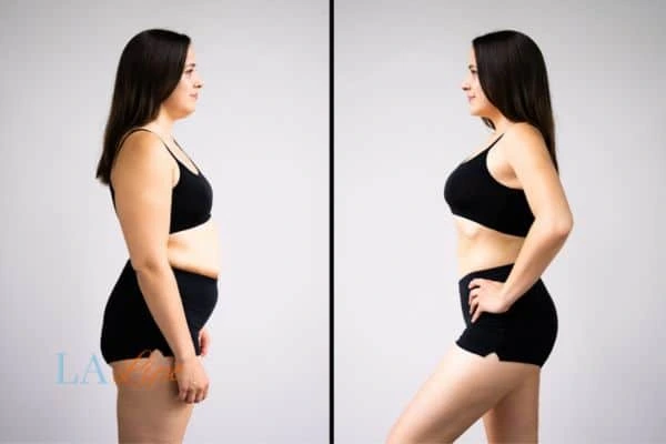 LA-EMS Body Sculpting Waltham's Cross results before and after of womans results on body toning.