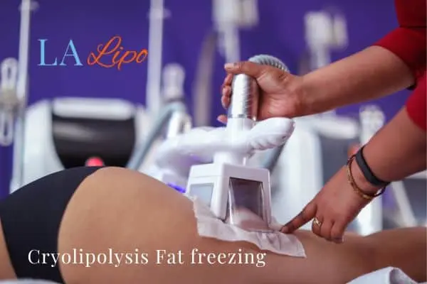 women getting fat freezing Waltham's Cross