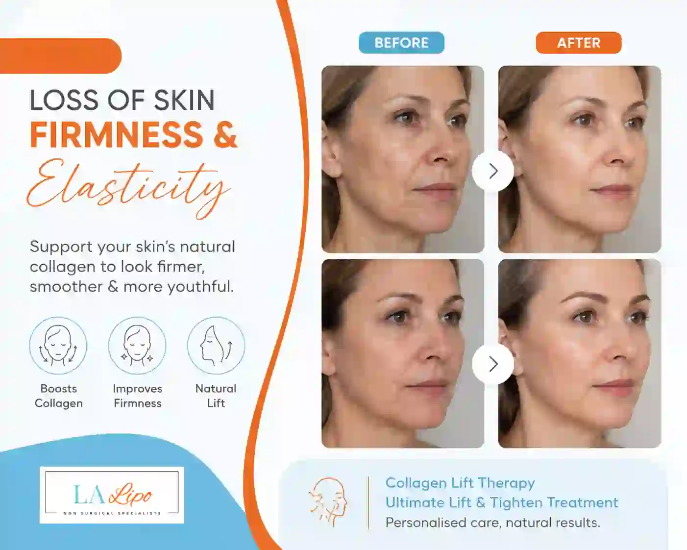 Sign #7: Loss of Skin Firmness and Elasticity Waltham's Cross